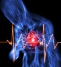 Congenital Heart Defects