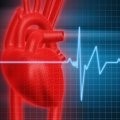 Transcatheter aortic valve replacement