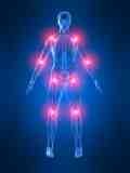 Joint replacement surgeries