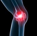 Knee Pain with Dr. Robert Bayless