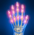 Alternative Medicine for Arthritis