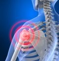 Shoulder Issues
